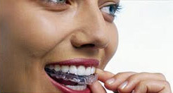 Teeth Whitening Wearing Tray