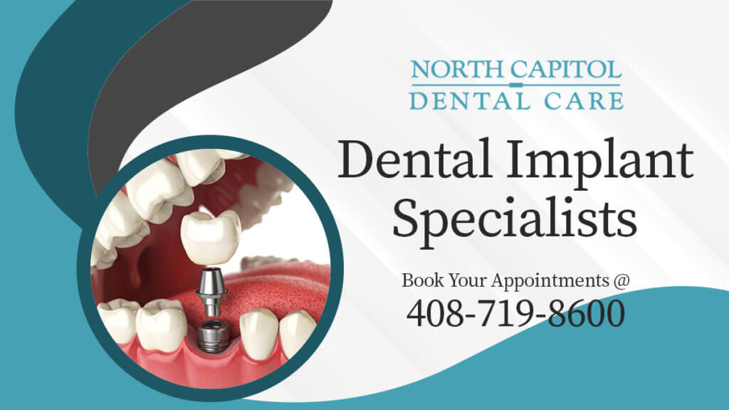 Dental Implants Specialist