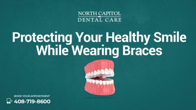 Protecting Your Healthy Smile While Wearing Braces