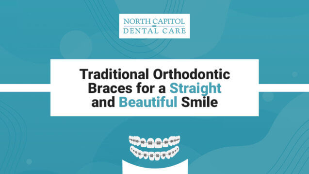 Traditional orthodontic braces for a straight and beautiful smile