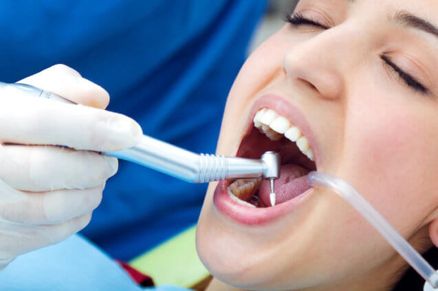 What You Should Know About Choosing the Best Types of Dental Implants