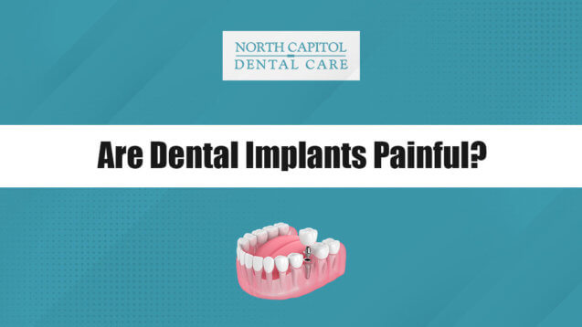 Are Dental Implants Painful? Exploring the Process at Our Dental Office