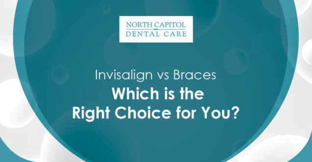 Invisalign vs Braces: Which is the Right Choice for You?