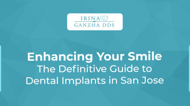 Enhancing Your Smile: The Definitive Guide to Dental Implants in San Jose